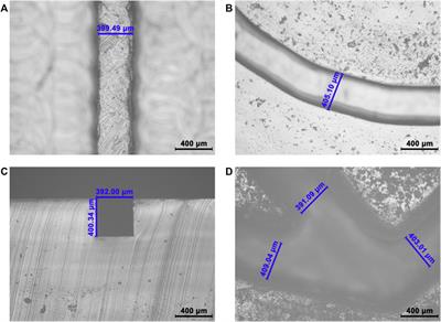 Point-of-Care Testing for Multiple Cardiac Markers Based on a Snail-Shaped Microfluidic Chip